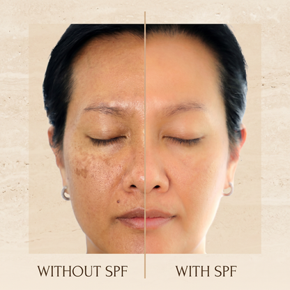 SKiNLY SPF5OStick